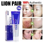 Advertisement for LION PAIR Acne Cream W with before and after acne treatment results.